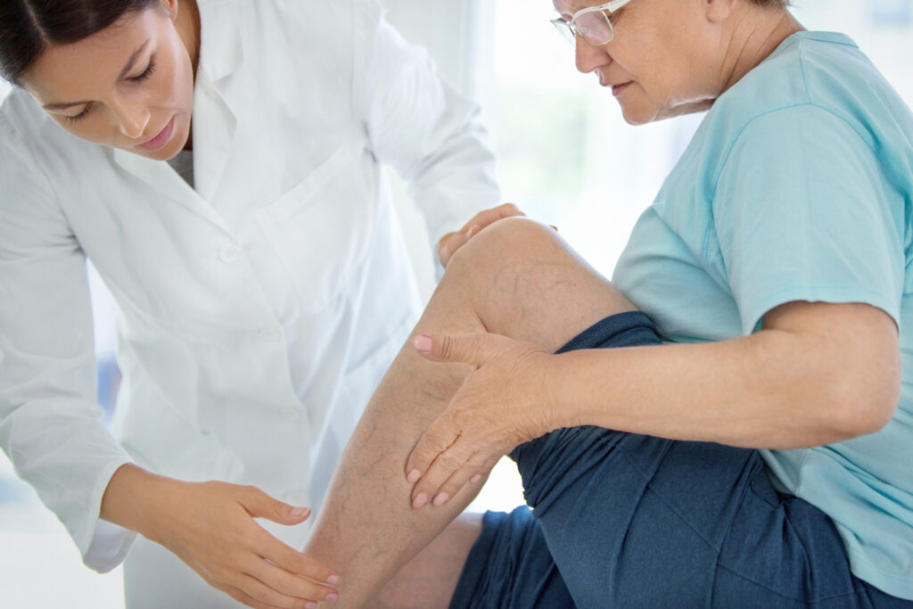 Older woman having her leg veins examined by her provider in preparation for non-surgical vein treatment.